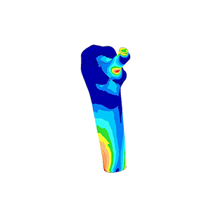 stress analysis model of hip implant